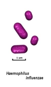gram negative rods drawing